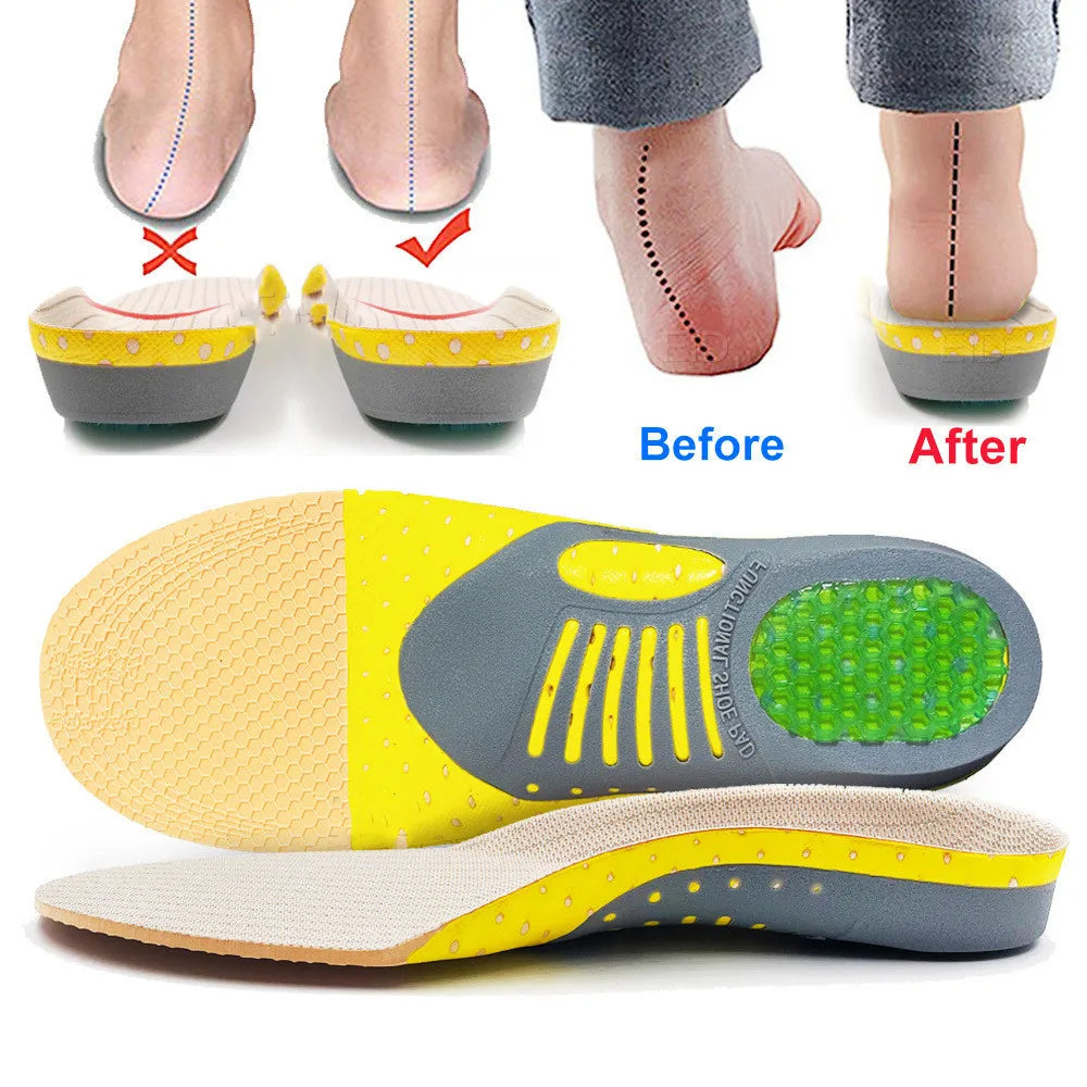 Orthopedic Insoles: Arch Support for Plantar Fasciitis Relief.